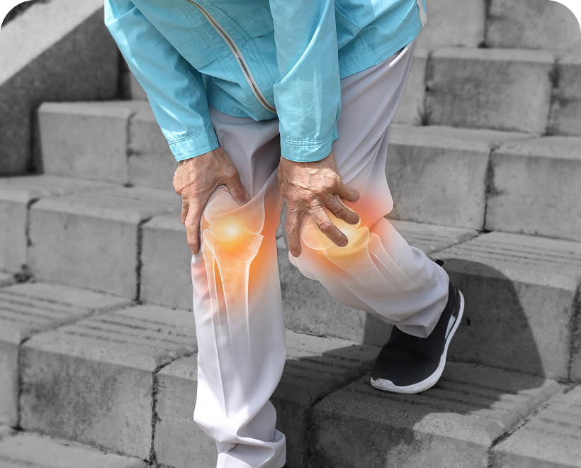 성모에스케이마취통증의학과의원 진료과목 소개 관절질환 이미지