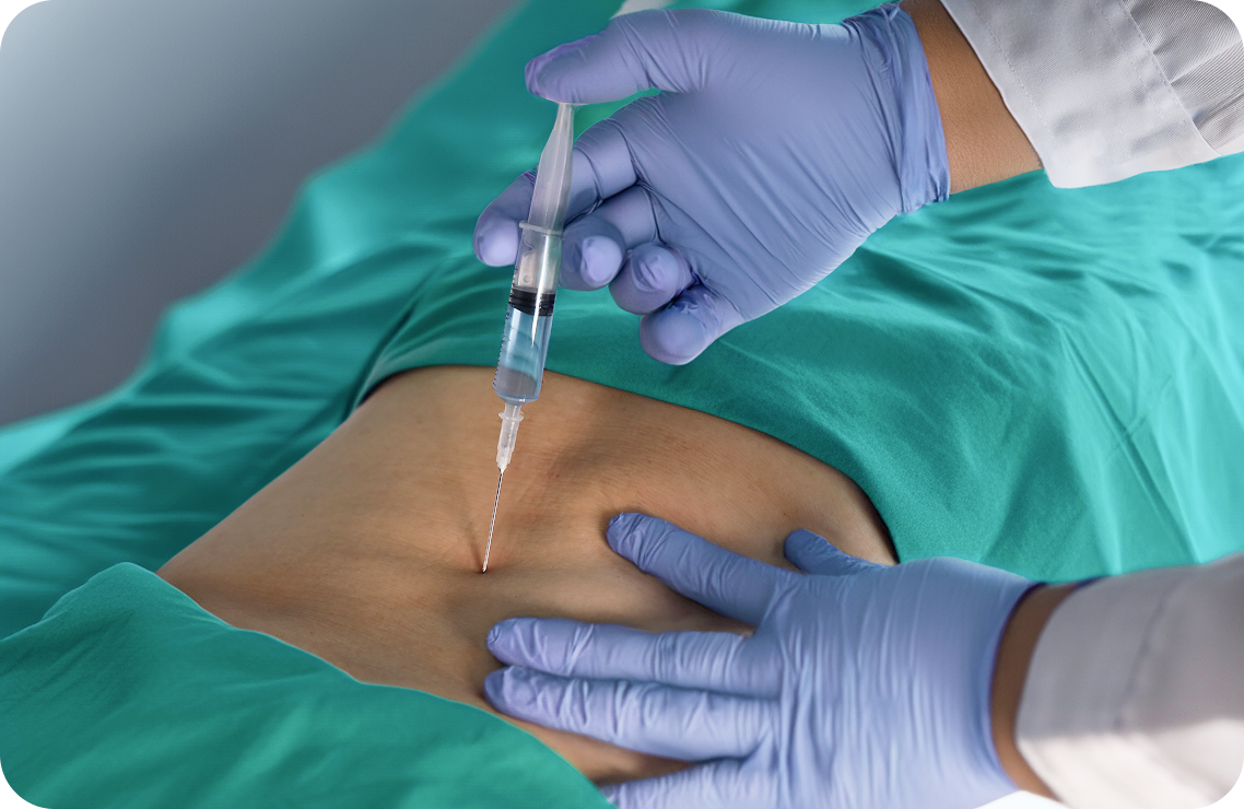 성모에스케이마취통증의학과의원 비수술 클리닉 신경차단술 이미지