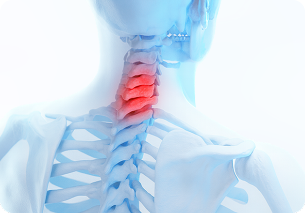 성모에스케이마취통증의학과의원 목디스크 탈출증 이미지
