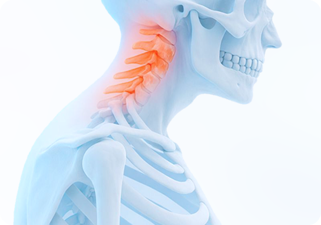 성모에스케이마취통증의학과의원 목디스크 탈출증 이미지