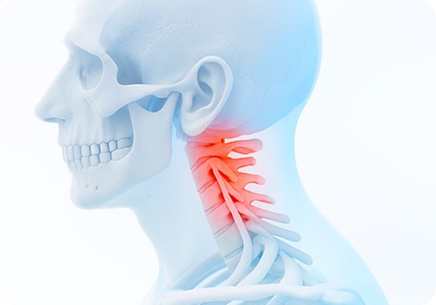 성모에스케이마취통증의학과의원 목디스크 탈출증 이미지