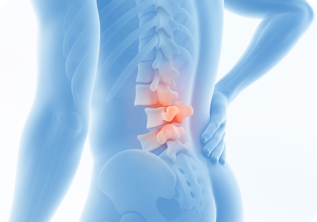성모에스케이마취통증의학과의원 목디스크 탈출증 이미지