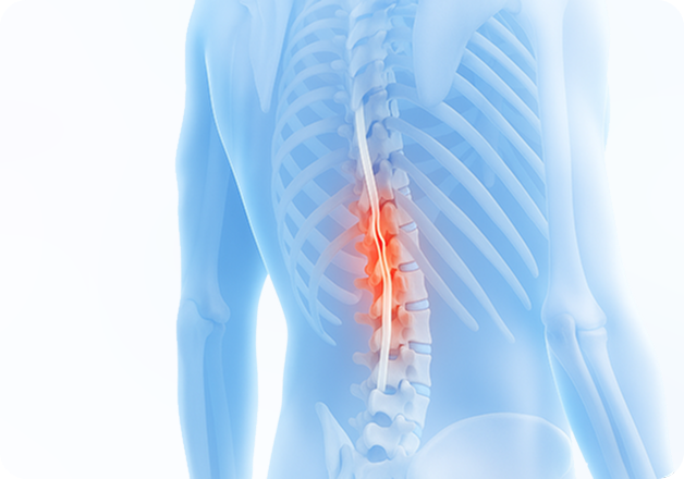 성모에스케이마취통증의학과의원 목디스크 탈출증 이미지