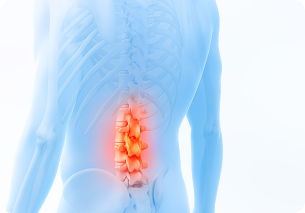 성모에스케이마취통증의학과의원 목디스크 탈출증 이미지