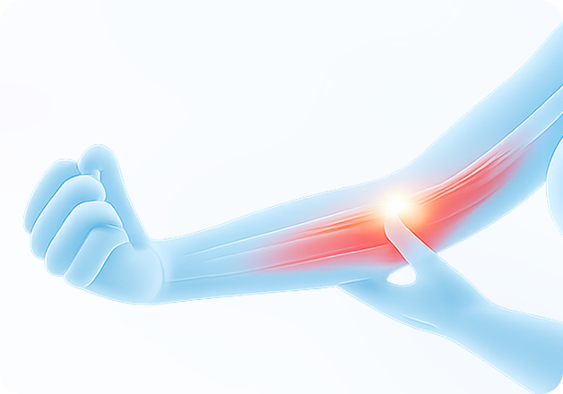 성모에스케이마취통증의학과의원 목디스크 탈출증 이미지