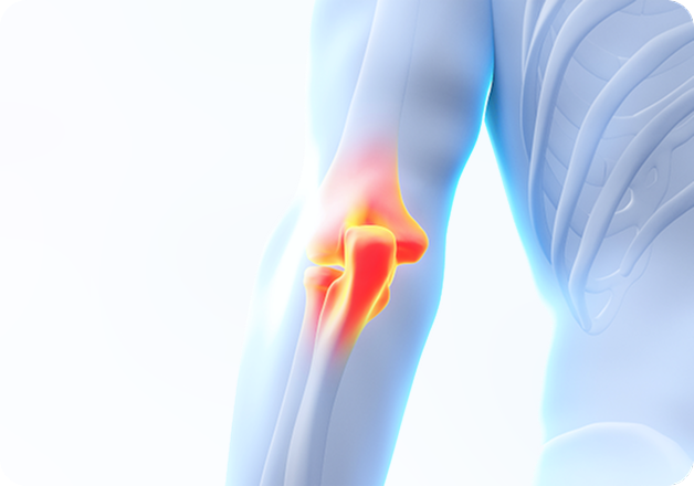 성모에스케이마취통증의학과의원 목디스크 탈출증 이미지