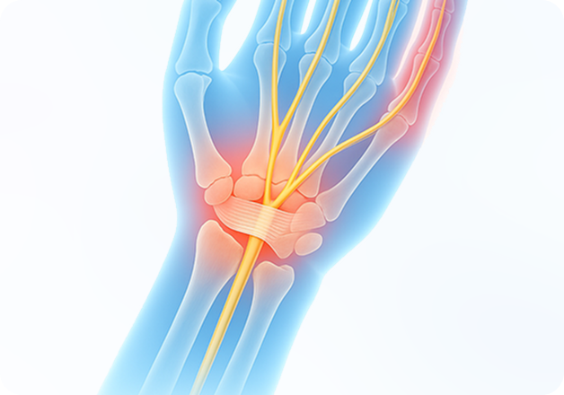 성모에스케이마취통증의학과의원 목디스크 탈출증 이미지