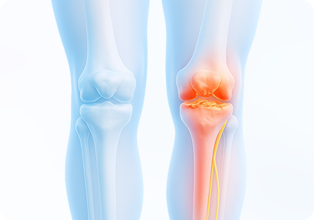 성모에스케이마취통증의학과의원 목디스크 탈출증 이미지