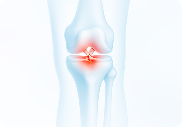성모에스케이마취통증의학과의원 목디스크 탈출증 이미지