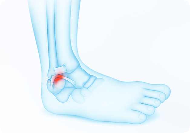 성모에스케이마취통증의학과의원 목디스크 탈출증 이미지