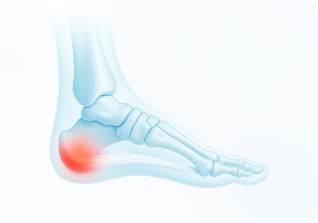 성모에스케이마취통증의학과의원 목디스크 탈출증 이미지