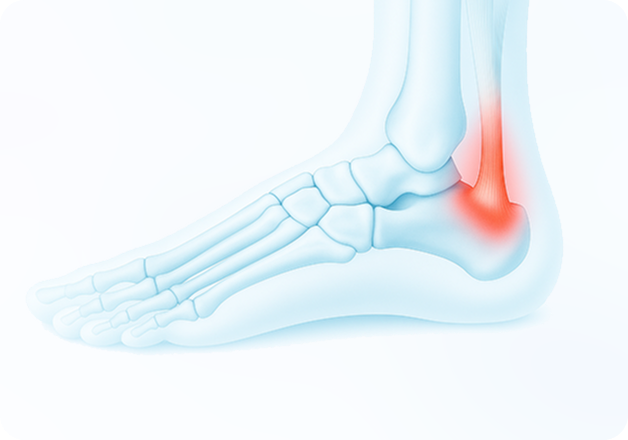 성모에스케이마취통증의학과의원 목디스크 탈출증 이미지