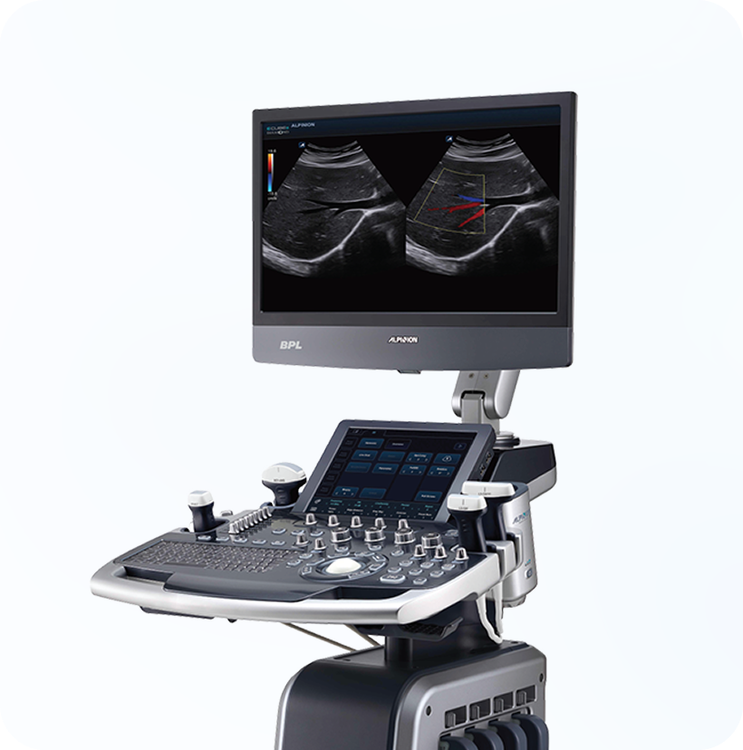 초음파 영상진단기